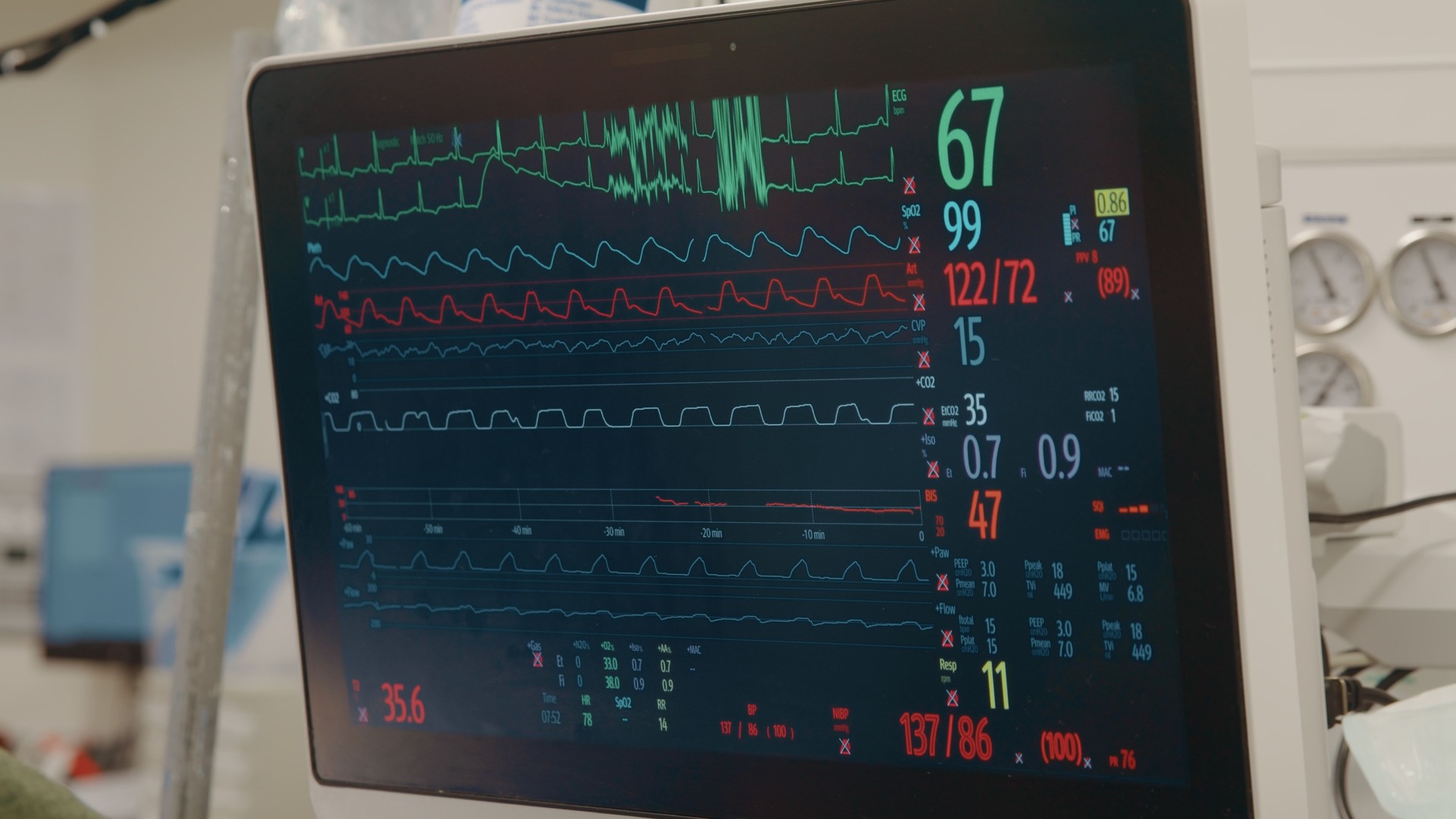 Operating patient monitor with vital signs